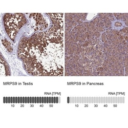 MRPS9 Antibody, Novus Biologicals 25 &mu;L, Unlabeled:Antibodies, Polyclonal