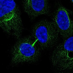 MRRF Antibody, Novus Biologicals:Antibodies:Primary Antibodies