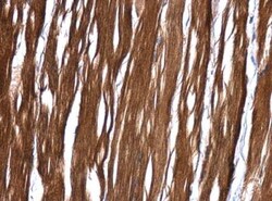 MRRF Antibody, Novus Biologicals 0.1 mL | Buy Online | Novus Biologicals | Fisher Scientific