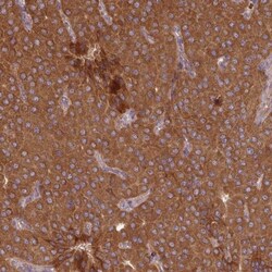 MRRF Antibody, Novus Biologicals 25 &mu;L, Unlabeled:Antibodies, Polyclonal