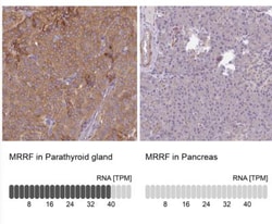 MRRF Antibody, Novus Biologicals:Antibodies:Primary Antibodies