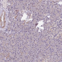 MRRF Antibody, Novus Biologicals:Antibodies:Primary Antibodies