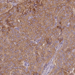 MRRF Antibody, Novus Biologicals:Antibodies:Primary Antibodies