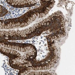 MRS2 Antibody, Novus Biologicals 25 &mu;L | Buy Online | Novus Biologicals | Fisher Scientific