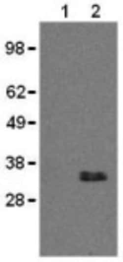 CD20 Antibody (AISB12) - BSA Free, Novus Biologicals 0.1mg; Unlabeled:Antibodies,