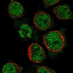 MS4A14 Rabbit anti-Human, Polyclonal, Novus Biologicals 25 &mu;g; Unconjugated:Antibodies,