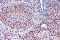 MSH2 Rabbit anti-Human, Mouse, Rat, Clone: 2L9I4, Novus Biologicals 100 &mu;g | Buy Online | Novus Biologicals | Fisher Scientific