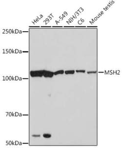 MSH2 Rabbit anti-Human, Mouse, Rat, Clone: 2L9I4, Novus Biologicals 100 &mu;g | Buy Online | Novus Biologicals | Fisher Scientific