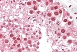 MSH5 Antibody, Novus Biologicals 0.1mg; Unlabeled:Antibodies, Polyclonal