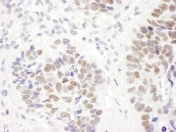 MSH6 Antibody, Novus Biologicals 100 &mu;L | Buy Online | Novus Biologicals | Fisher Scientific
