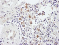 MSH6 Antibody, Novus Biologicals 0.1mg; Unlabeled:Antibodies, Polyclonal