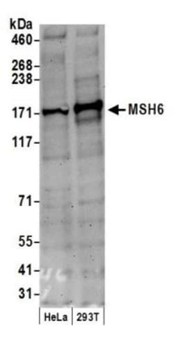 MSH6 Antibody, Novus Biologicals 100 &mu;L | Buy Online | Novus Biologicals | Fisher Scientific