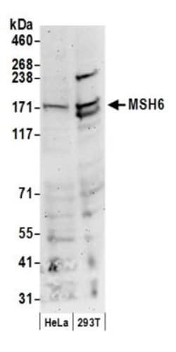 MSH6 Antibody, Novus Biologicals 0.1mg; Unlabeled:Antibodies, Polyclonal