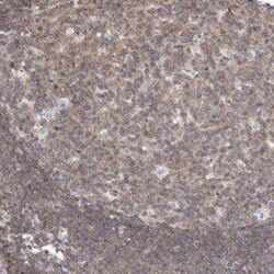 MSL3L1 Antibody, Novus Biologicals 0.1mL; Unlabeled:Antibodies, Polyclonal