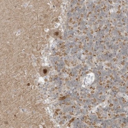 MSL3L1 Antibody, Novus Biologicals:Antibodies:Primary Antibodies