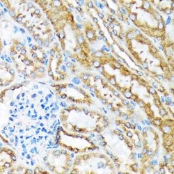 MSP/MST1 Rabbit anti-Human, Mouse, Rat, Clone: 5R7X2, Novus Biologicals