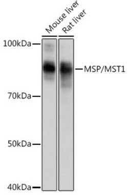 MSP/MST1 Rabbit anti-Human, Mouse, Rat, Clone: 5R7X2, Novus Biologicals