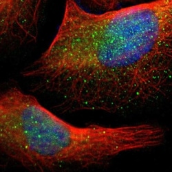 MSPR/Ron Antibody, Novus Biologicals 0.1mL; Unlabeled:Antibodies, Polyclonal