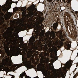 MSPR/Ron Antibody, Novus Biologicals 25 &mu;L; Unlabeled:Antikörper