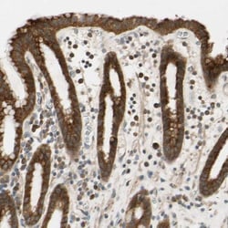 MSPR/Ron Antibody, Novus Biologicals 25 &mu;L; Unlabeled:Antikörper