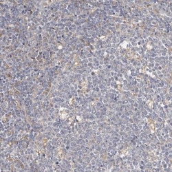 MSRB2 Antibody, Novus Biologicals 0.1mL; Unlabeled:Antibodies, Polyclonal