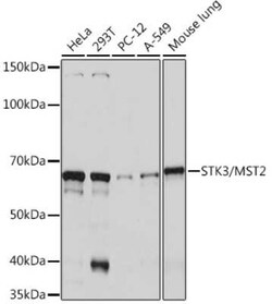 MST2/STK3 Rabbit anti-Human, Mouse, Rat, Clone: 5J1I4, Novus Biologicals 20 &mu;g | Buy Online | Novus Biologicals | Fisher Scientific