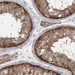 MST3 Antibody, Novus Biologicals:Antibodies:Primary Antibodies