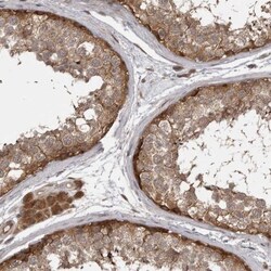 MST3 Antibody, Novus Biologicals 0.1mL; Unlabeled:Antibodies, Polyclonal