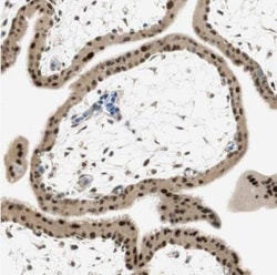 MSX2 Antibody, Novus Biologicals 0.1mL; Unlabeled:Antibodies, Polyclonal