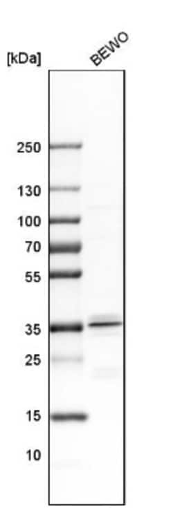 MSX2 Antibody, Novus Biologicals 0.1mL; Unlabeled:Antibodies, Polyclonal