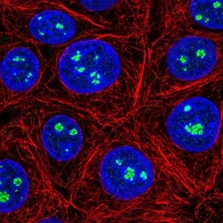 MSY2 Antibody, Novus Biologicals 0.1mL; Unlabeled:Antibodies, Polyclonal