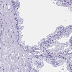 MSY2 Antibody, Novus Biologicals 0.1mL; Unlabeled:Antibodies, Polyclonal