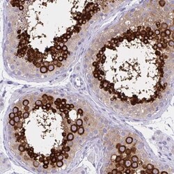 MSY2 Antibody, Novus Biologicals 0.1mL; Unlabeled:Antibodies, Polyclonal