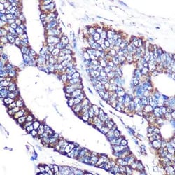 MT-CO2 Rabbit anti-Human, Clone: 6H0N5, Novus Biologicals:Antibodies:Primary