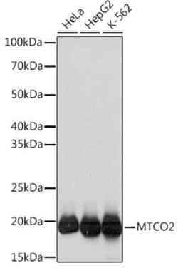 MT-CO2 Rabbit anti-Human, Clone: 6H0N5, Novus Biologicals:Antibodies:Primary