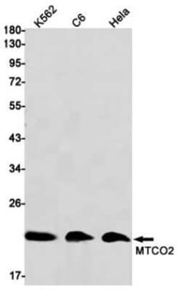 MT-CO2 Rabbit anti-Human, Clone: S05-7E7, Novus Biologicals 25 &mu;g; Unconjugated:Antibodies,