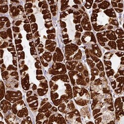 MT-CO2 Antibody, Novus Biologicals 0.1mL; Unlabeled:Antibodies, Polyclonal