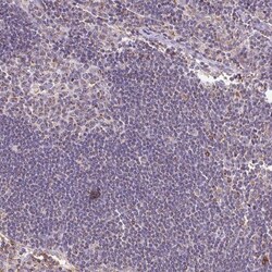 MT-CO2 Antibody, Novus Biologicals 0.1mL; Unlabeled:Antibodies, Polyclonal