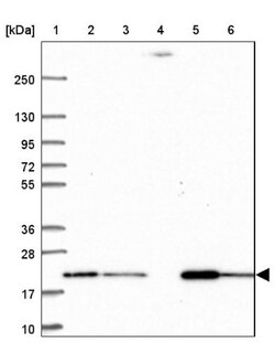 MT-CO2 Antibody, Novus Biologicals 0.1mL; Unlabeled:Antibodies, Polyclonal