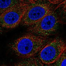 MT-ND3 Antibody, Novus Biologicals 0.1mL; Unlabeled:Antibodies, Polyclonal