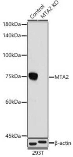 MTA2 Rabbit anti-Human, Clone: 9A5Y7, Novus Biologicals 100 &mu;g; Unconjugated:Antibodies,