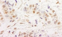 MTA3 Antibody 0.1mg; Unlabeled:Antibodies, Polyclonal