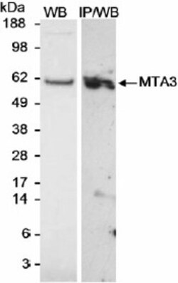 MTA3 Antibody 0.1mg; Unlabeled:Antibodies, Polyclonal