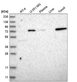 EZFIT/ZNF71 Antibody, Novus Biologicals:Antibodies:Primary Antibodies