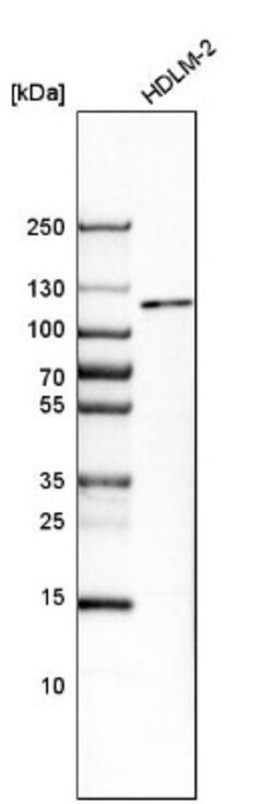 PPP1R14D/GBPI-1 Antibody, Novus Biologicals:Antibodies:Primary Antibodies