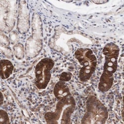 MTHFD1 Antibody, Novus Biologicals 0.1mL; Unlabeled:Antibodies, Polyclonal