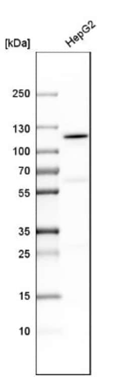 MTHFD1 Antibody, Novus Biologicals 0.1mL; Unlabeled:Antibodies, Polyclonal