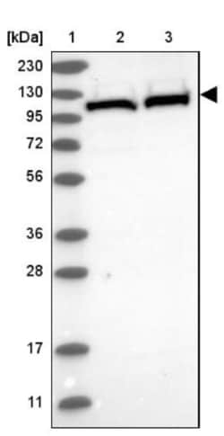 MTHFD1L Antibody, Novus Biologicals 25 &mu;L | Buy Online | Novus Biologicals | Fisher Scientific