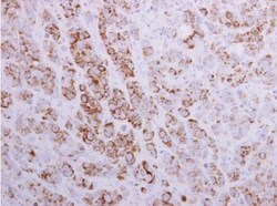 MTHFD2 Antibody, Novus Biologicals 0.1mL; Unlabeled:Antibodies, Polyclonal
