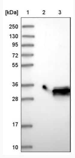 MTHFS Antibody, Novus Biologicals 0.1mL; Unlabeled:Antibodies, Polyclonal